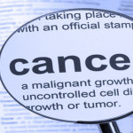 Simple Bad Luck – Cause For Many Cancers – Say Researchers